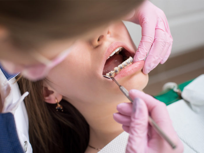 traitement orthodontie enfant dr jacob orthodontiste la rochelle