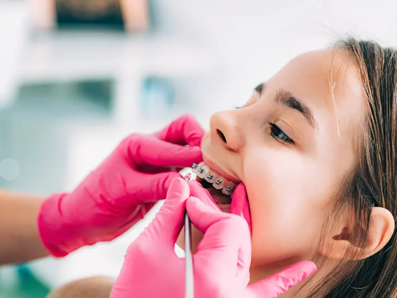 Traitement orthodontie pour enfant docteur Jacob orthodontiste à La Rochelle